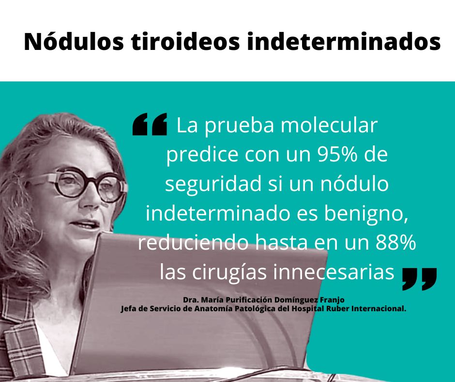 Prueba molecular para nódulos tiroideos indeterminados